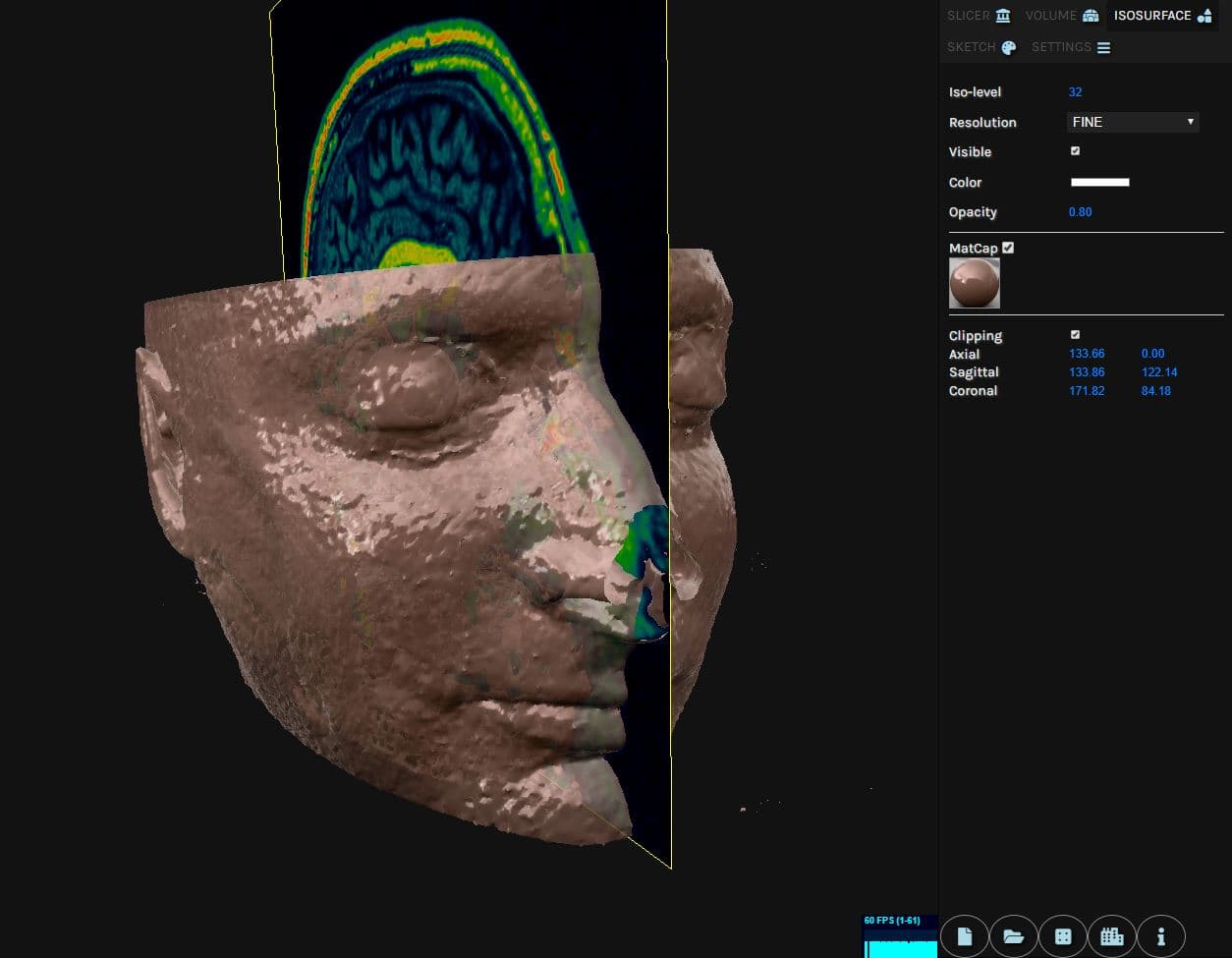 medIsosurface